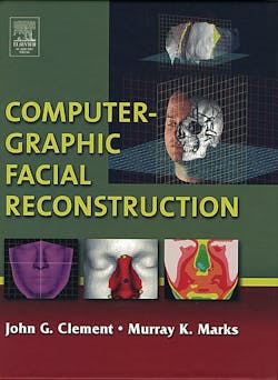 Computergraphicfacialreconstruction 10040626