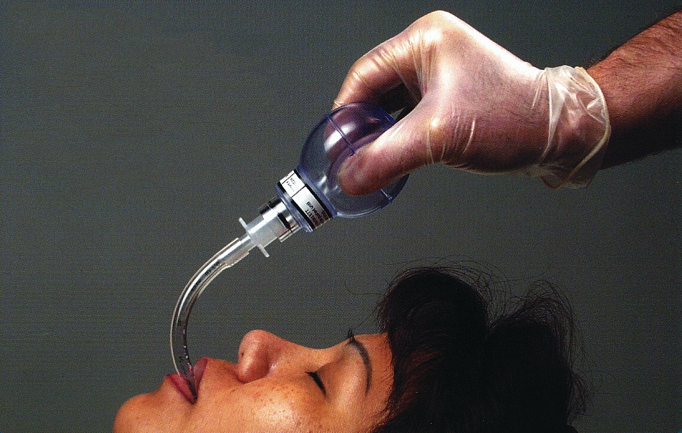 Esophagealintubationdetector 10047637