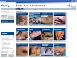 Visualdx 10044621 Visualdx 10044621