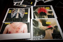 Homelessdeath 10344914 Homelessdeath 10344914