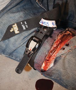 Rmt Leg 10815074 Rmt Leg 10815074