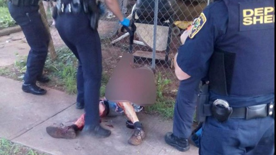 A Greenville County deputy shot and killed a dog that attacked and injured two women Tuesday morning.