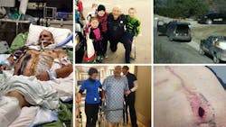 Deuel County Deputy Mike Hutchinson is fighting to regain health insurance as he continues to recover from four gunshot wounds sustained while serving an arrest warrant on Dec. 3, 2015. Deuel County Deputy Mike Hutchinson is fighting to regain health insurance as he continues to recover from four gunshot wounds sustained while serving an arrest warrant on Dec. 3, 2015.