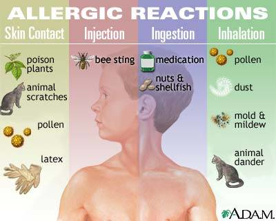 Anaphylaxis: What You Need To Know About Life Or Death Allergic ...