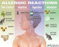 Allergy Pinterest 58f4ba1728b98 Allergy Pinterest 58f4ba1728b98
