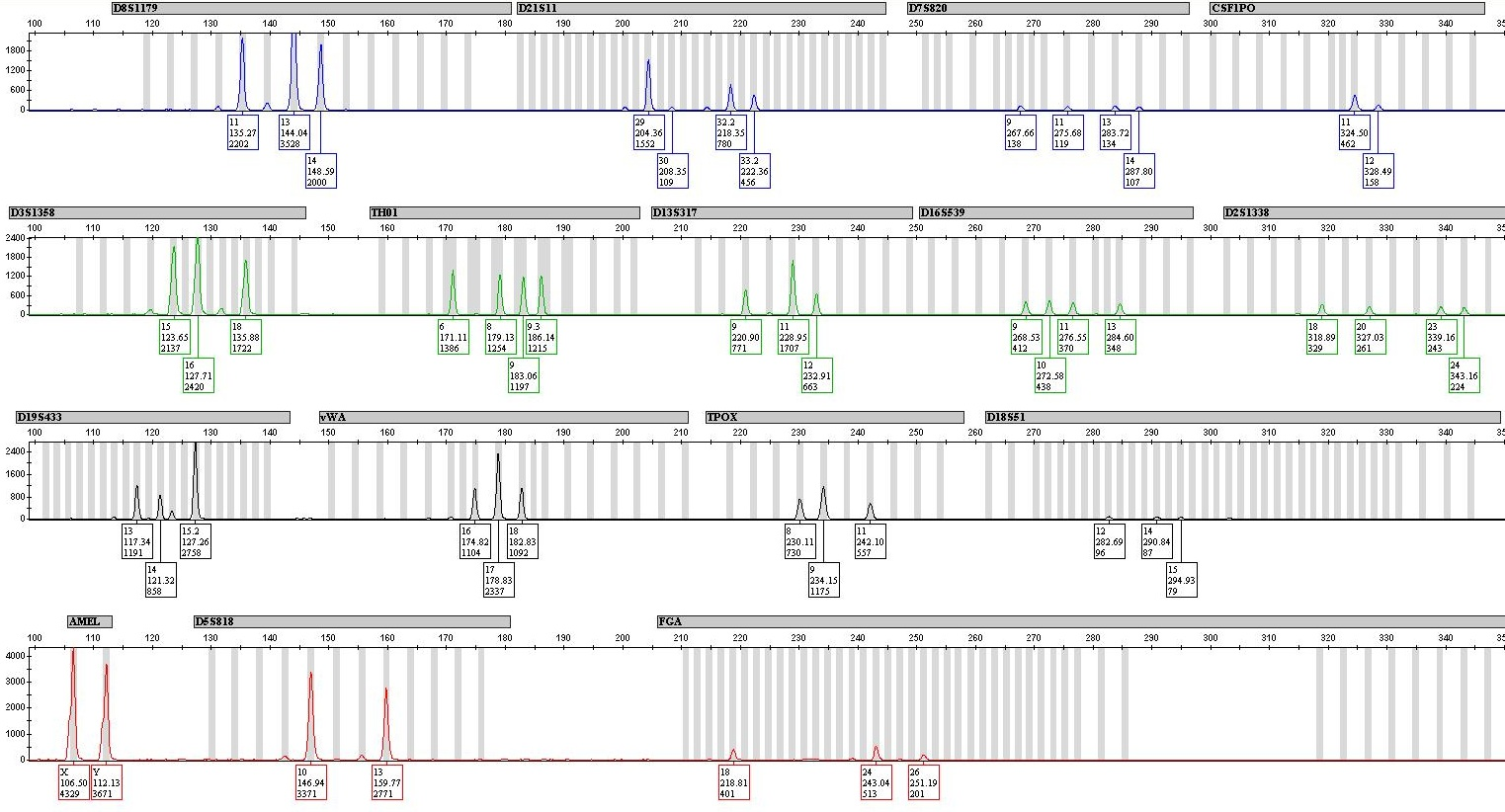 Seen here, an EPG for a case where the DNA profile was unsuitable for database searching. The forensic software of STRmix&trade; was able to interpret the profile assuming two contributors and compared against a database with over 145,000 profiles.