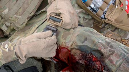 Tmt Locking Action D8kazet 4er6a Cuf