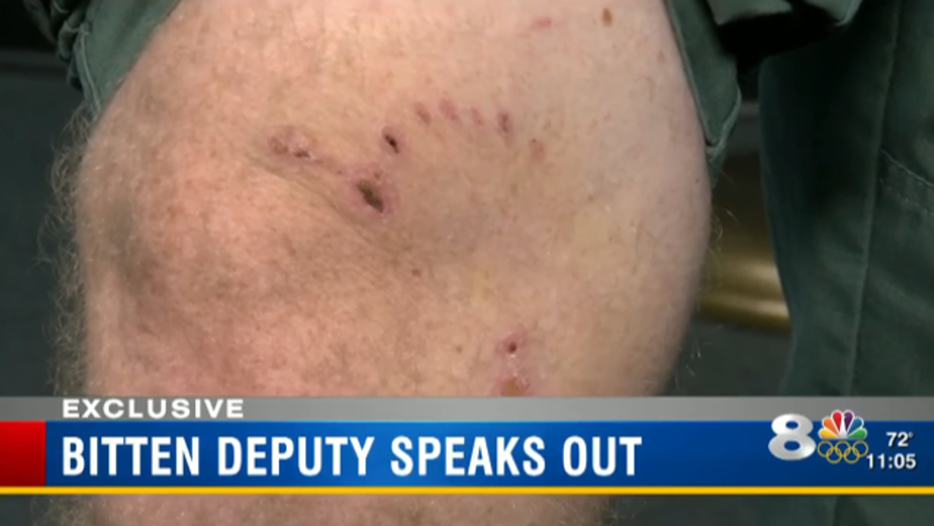 Deputyspeaksout