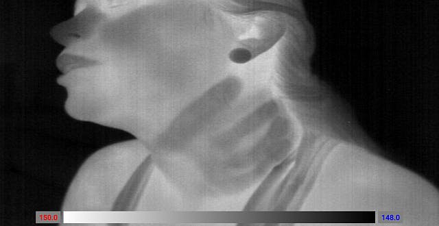 This image was taken with an i3 Thermal Expert and shows heat signatures on the victim&rsquo;s neck. Infrared cameras enable users to capture high resolution thermal images.
