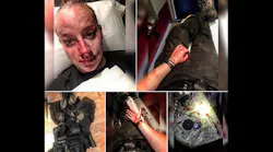 Brooke County Sheriff's Deputy Kristen Richmond, who was beaten in a struggle with a suspect early Friday morning, posted photos of her injuries and an account of the incident to Facebook which has since gone viral.