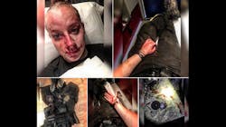 Brooke County Sheriff's Deputy Kristen Richmond, who was beaten in a struggle with a suspect early Friday morning, posted photos of her injuries and an account of the incident to Facebook which has since gone viral. Brooke County Sheriff's Deputy Kristen Richmond, who was beaten in a struggle with a suspect early Friday morning, posted photos of her injuries and an account of the incident to Facebook which has since gone viral.