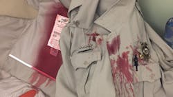 A Jefferson County Sheriff’s deputy was discharged from a hospital Thursday after being attacked by a dog while on duty earlier in the week. A Jefferson County Sheriff’s deputy was discharged from a hospital Thursday after being attacked by a dog while on duty earlier in the week.