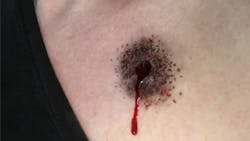 The effect of a bullet entry wound from the MasterCast line from Moulage Concepts Inc. The effect of a bullet entry wound from the MasterCast line from Moulage Concepts Inc.