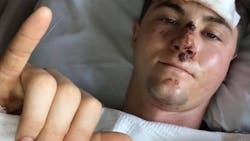 Lufkin Police Officer Seth Thompson is seen recovering in the hospital after he was struck by an SUV on Saturday. Lufkin Police Officer Seth Thompson is seen recovering in the hospital after he was struck by an SUV on Saturday.