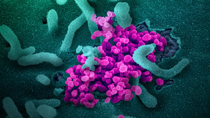 Coronavirus 5e7e03c7e6cd6