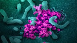 Coronavirus 5e7e03c7e6cd6 Coronavirus 5e7e03c7e6cd6