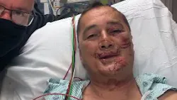 Greene County Sheriff's Lt. Steve Westbrook is recovering after he was deliberately struck by a suspect during a pursuit on Friday. Greene County Sheriff's Lt. Steve Westbrook is recovering after he was deliberately struck by a suspect during a pursuit on Friday.