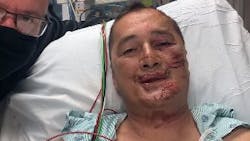 Greene County Sheriff&apos;s Lt. Steve Westbrook is recovering after he was deliberately struck by a suspect during a pursuit on Friday.