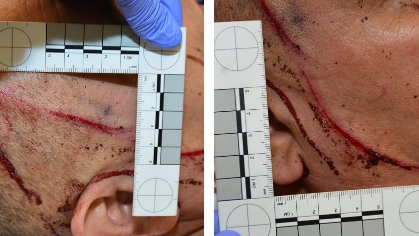 A Fresno, CA, police detective suffered a puncture wound to the head, a concussion and other injuries when he was stabbed multiple times by a man at the department's headquarters Tuesday.