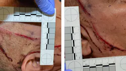A Fresno, CA, police detective suffered a puncture wound to the head, a concussion and other injuries when he was stabbed multiple times by a man at the department's headquarters Tuesday. A Fresno, CA, police detective suffered a puncture wound to the head, a concussion and other injuries when he was stabbed multiple times by a man at the department's headquarters Tuesday.