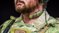 Qcollar2 63628076df3ac Qcollar2 63628076df3ac