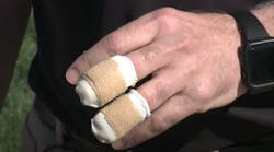 Indianola Police Officer Finger Loss (ia)