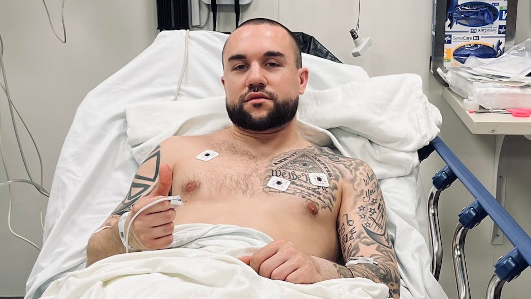 Thurston County, WA, Sheriff Derek Sanders was injured and hospitalized after he was involved in a two-car collision near Yelm on Sunday.