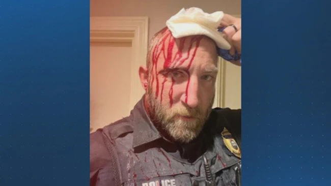 &lsquo;Severe bleeding&rsquo;: Two Marshfield Police officers hospitalized after responding to well-being check