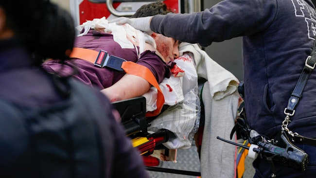 A 19-year-old man was stabbed in the back Wednesday in an unprovoked attack outside Manhattan Summons Court, only 500 feet from NYPD headquarters.