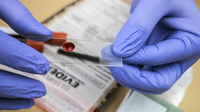 The Pennsylvania Supreme Court Ruled That Police, In Most Cases, Must Obtain A Search Warrant To Draw Blood From An Injured Or Impaired Driver Who Can't Or Won't Give Consent