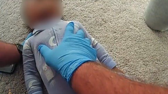 A 1-year=old girl who became unresponsive because of a febrile seizure was resuscitated thanks to the quick response of a Lee County sheriff's deputy, who performed CPR until medics arrived.